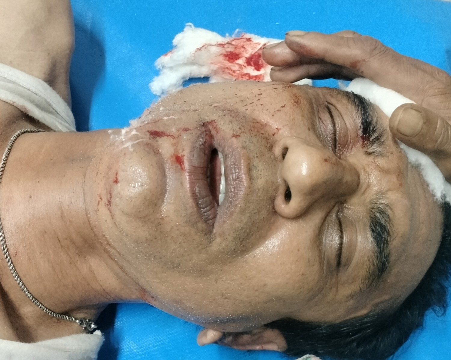 নড়াইলের কালিয়ায় বিএনপির ৫ নেতাকর্মী আহত দেশি অস্ত্রসহ সেনাবাহিনীর হাতে আটক ৪