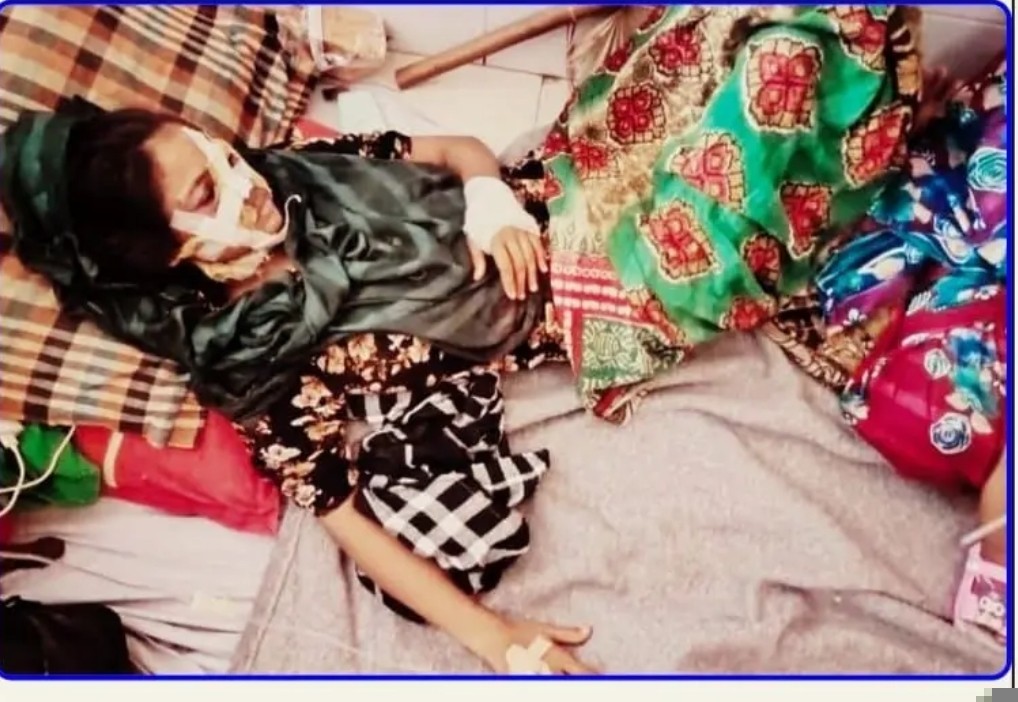 নড়াগাতীতে মধ্য রাতে তালাক প্রাপ্ত স্ত্রীকে অতর্কিত  হামলায় গুরুতর আহত