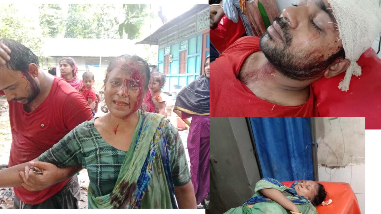 লক্ষ্মীপুরে অটো চালকের বসতঘরে হামলা-ভাঙচুর, আহত -৩